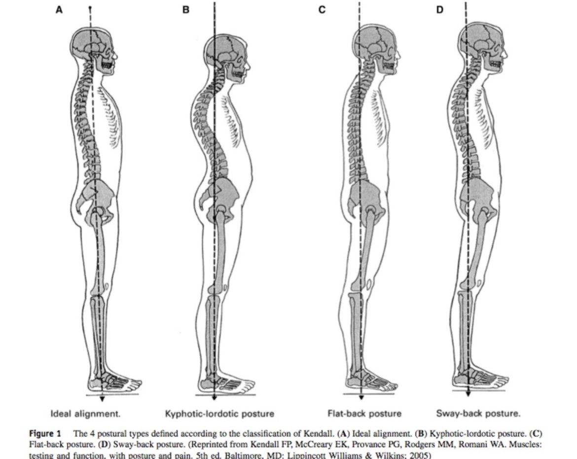 posture analysis pilates